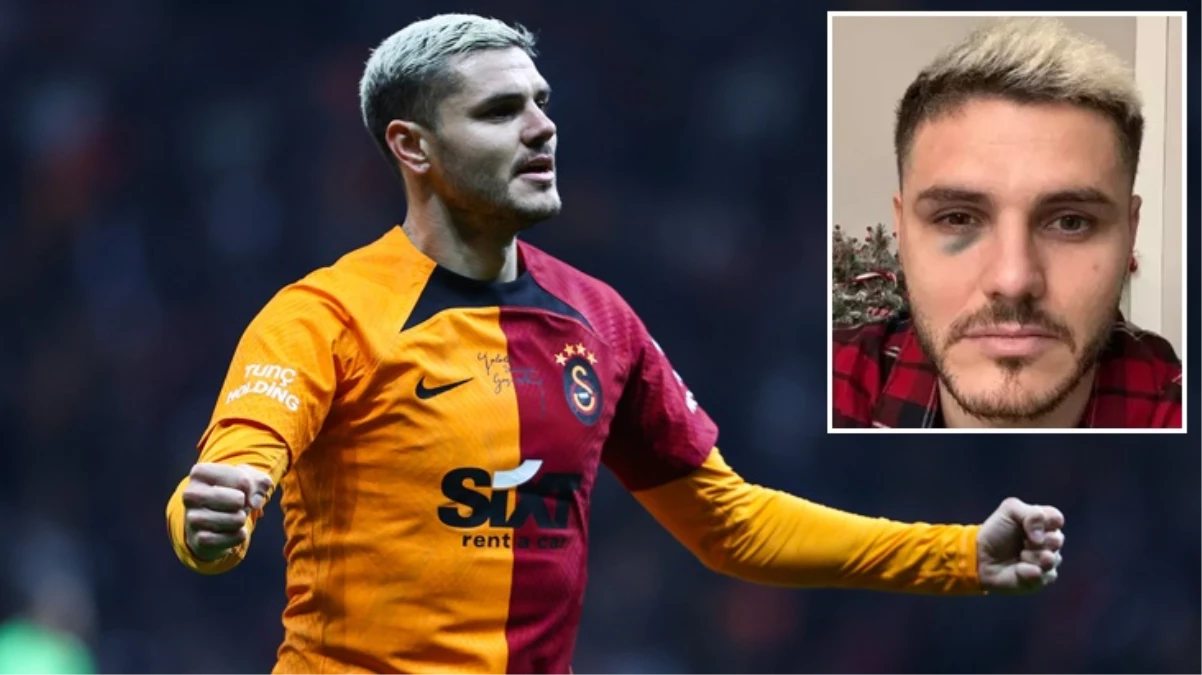 Galatasaray'da Mauro Icardi depremi! Bir süre yeşil sahalardan uzak kalacak