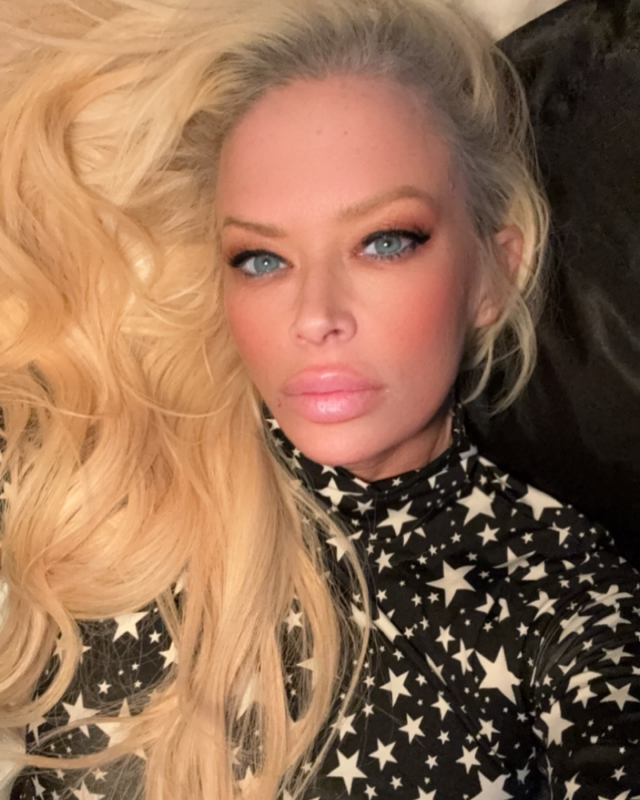 Nadir görülen rahatsızlıkla mücadele eden yetişkin film yıldızı Jenna Jameson, aldığı kilolarla dikkat çekti